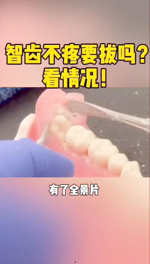 智齿拔除视频,视频带你直观了解拔牙体验