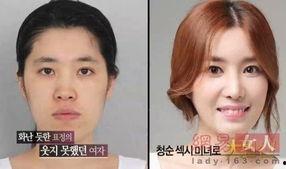 韩国整容手术,美丽背后的秘密与争议