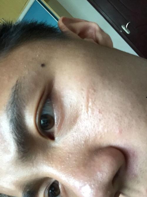 脸上有小黑点图片,揭秘小黑点成因与应对策略