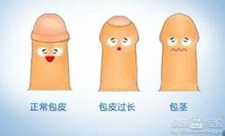 男性龟头炎图片大全,男性龟头炎症状图解与防治要点