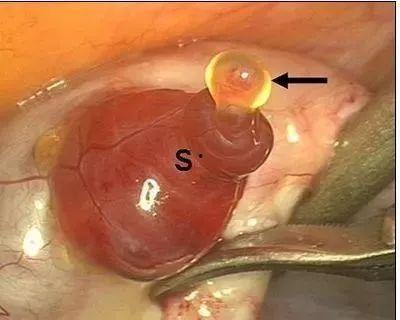 排卵过程视频,揭秘女性生殖周期的奥秘