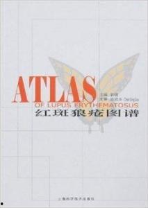 红斑狠疮图片大全,图片解析与疾病认知
