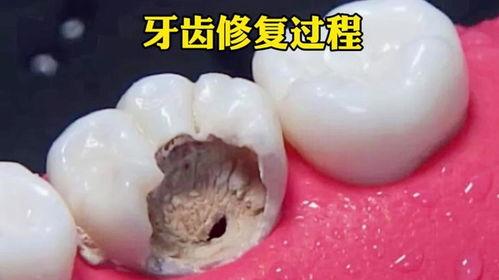 牙齿视频,从视频看口腔护理之道